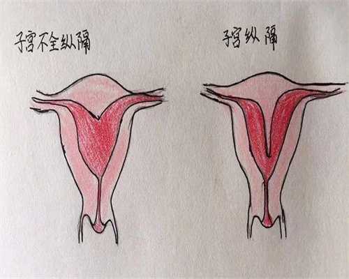 输卵管切除试管